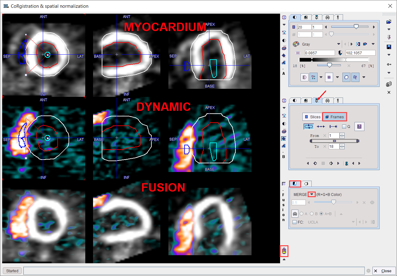 PCARD Data in Fusion