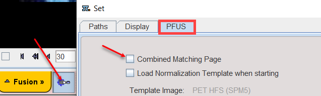 ConfigurationLayout_OFF