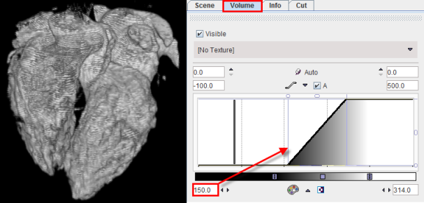 P3D Contrasf filled Venticles