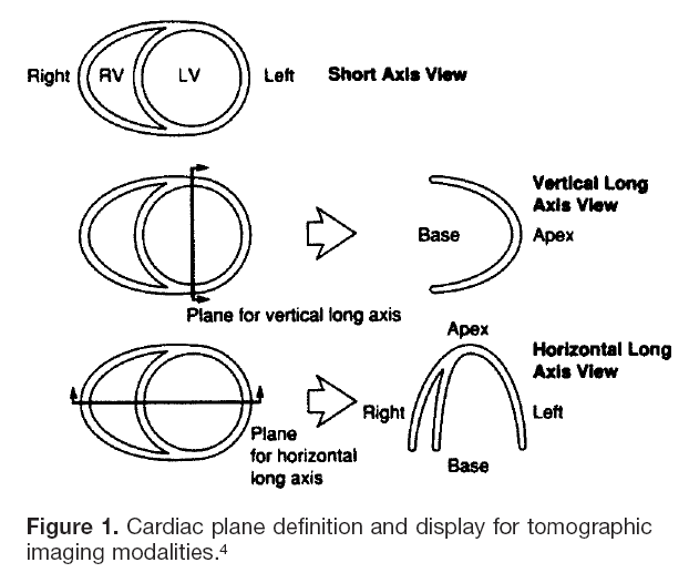 PCARD Plane Orientations