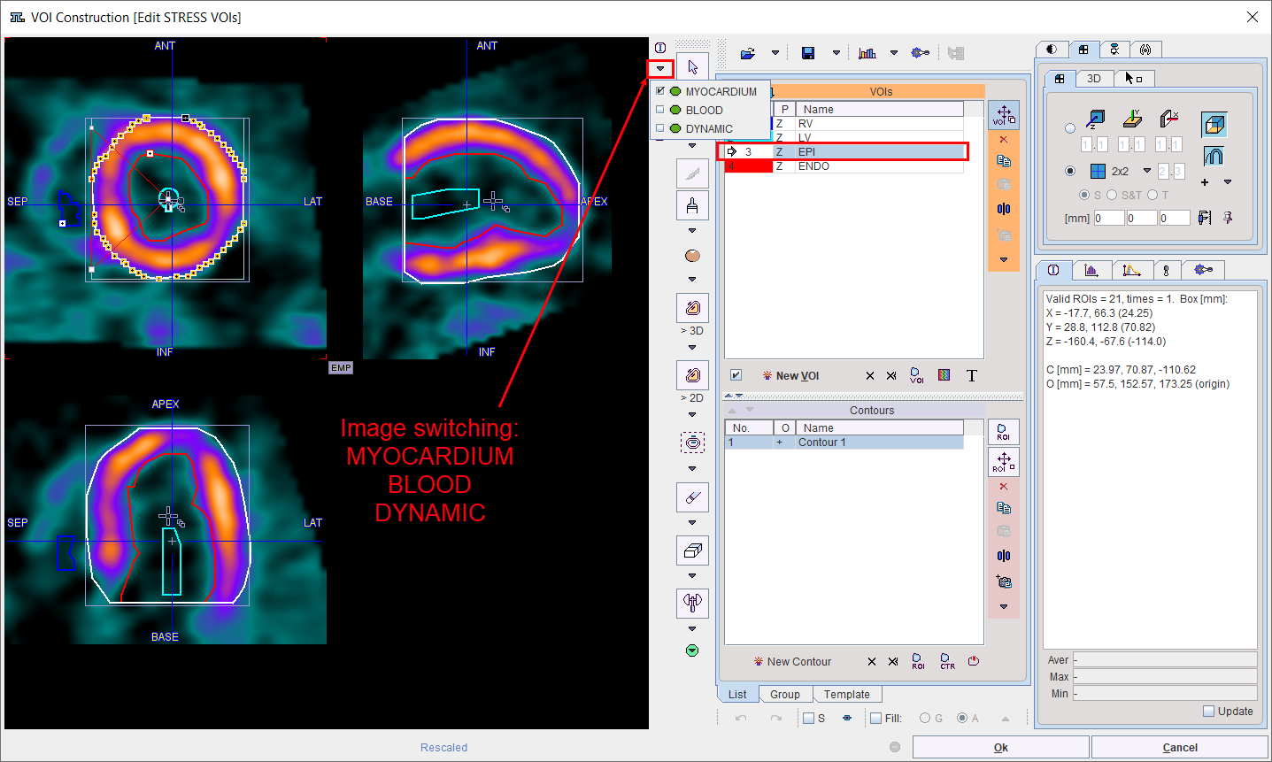 PCARD VOI Editing Dialog