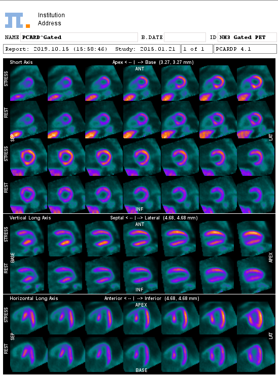 GatedCardiologicalReport