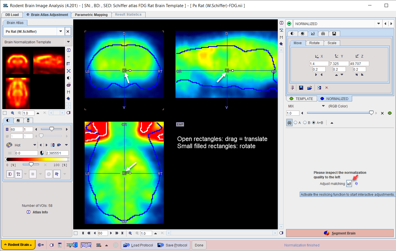 SingleModalityManualNormalization