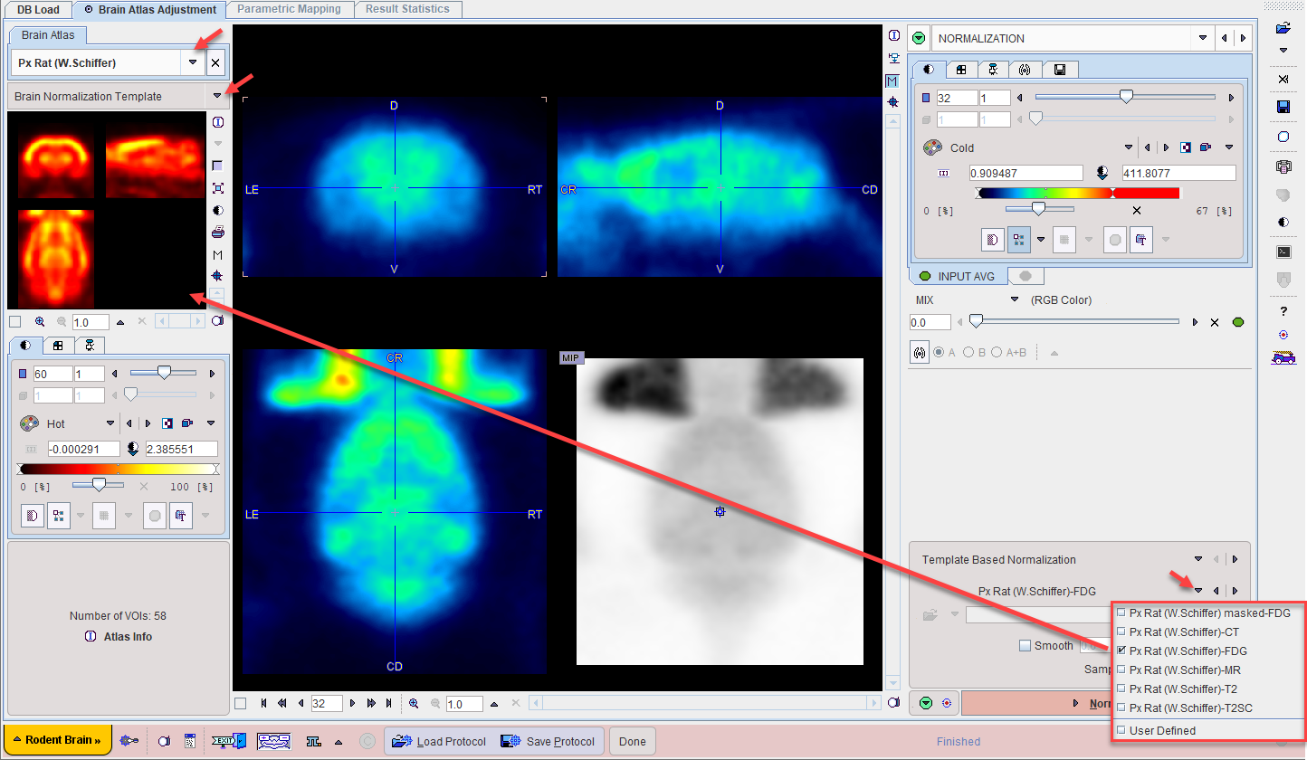 SingleModalityNormalization